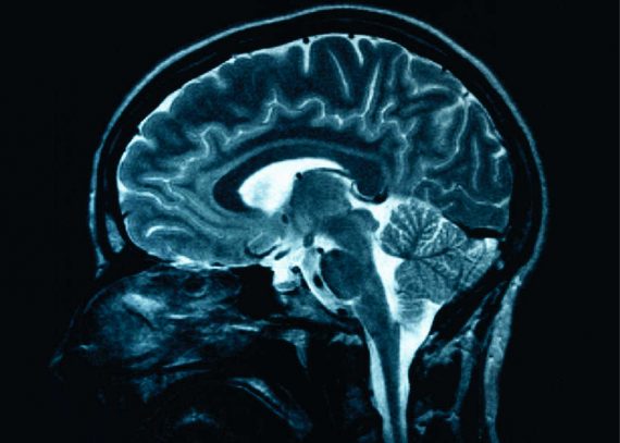[Image of a human brain]