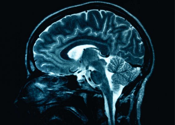 Brain Image